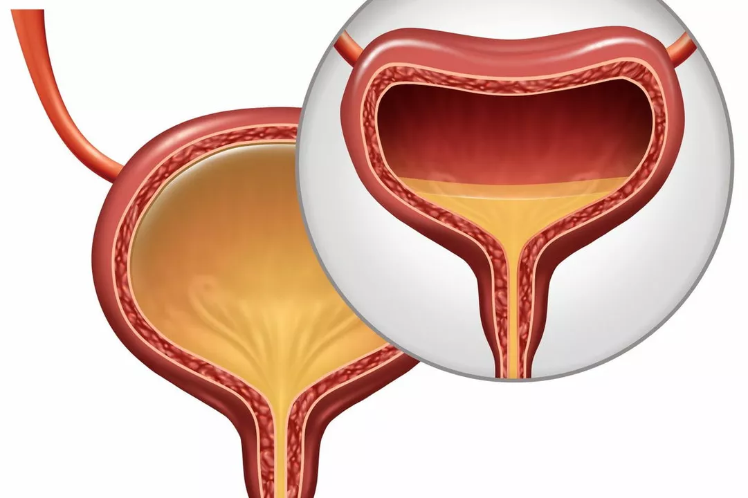 L'impact des symptômes de la vessie et de l'incontinence urinaire sur la vie quotidienne