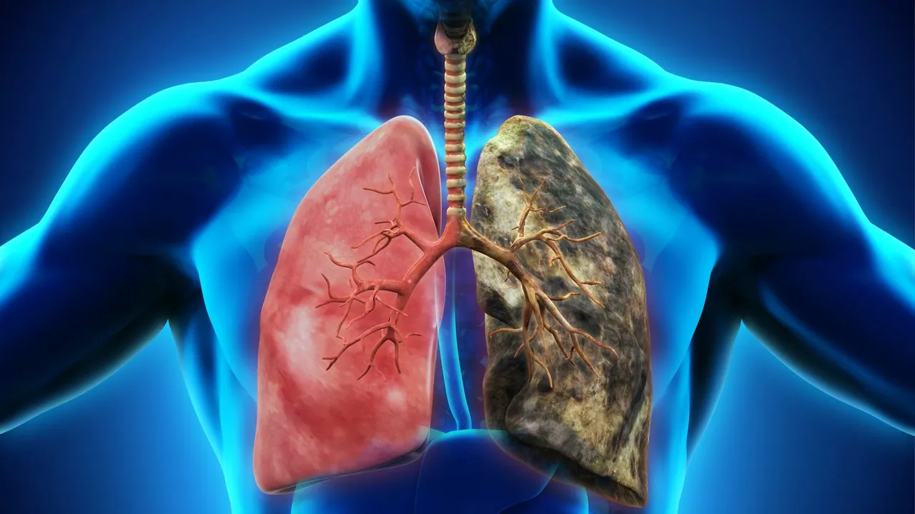 Comprendre les Causes et les Symptômes de l'Inflammation Pulmonaire